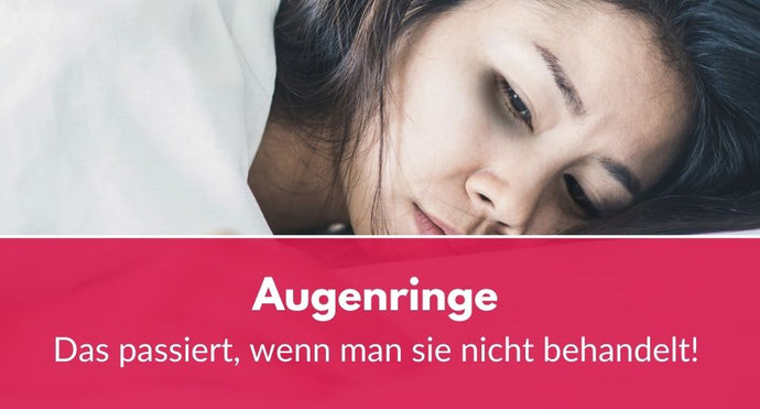 Das passiert, wenn man Augenringe nicht behandelt!