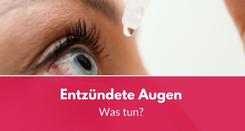 Entzündete Augen: Was tun bei Rötung und Schwellung?