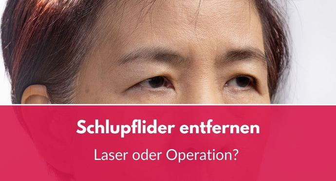 Schlupflider entfernen: Laser oder Operation?