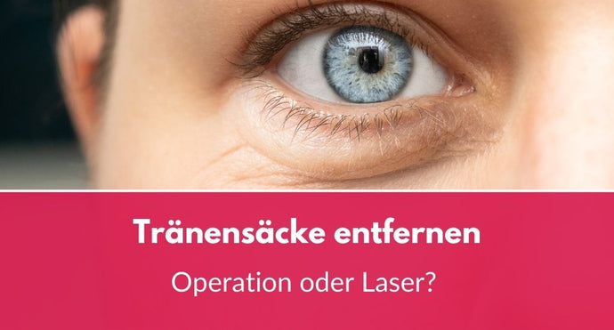 Tränensäcke entfernen: Operation oder Laser?